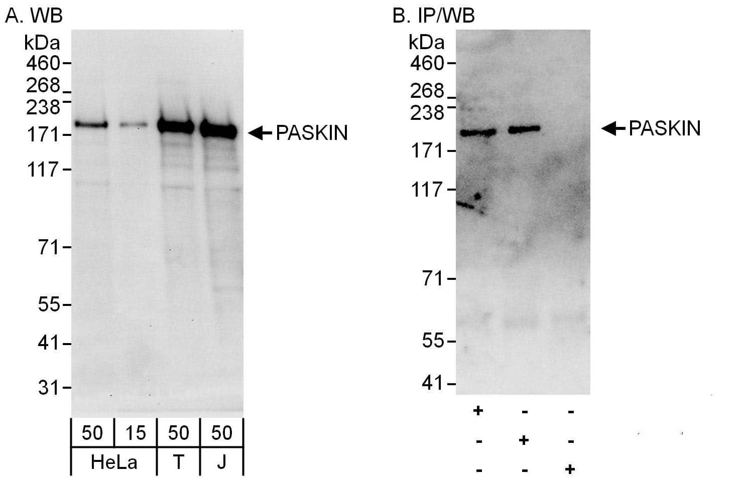 Western Blot:[NBP3-30457]-Detection of human PASKIN by western blot and immunoprecipitation. Samples: Whole cell lysate from HeLa , HEK293T and Jurkat cells. Antibodies: Affinity purified rabbit anti-PASKIN antibody used for WB at 0. 4 µg/ml and 1 µg/ml and used for IP at 6 µg/mg lysate. PASKIN was also immunoprecipitated by rabbit anti-PASKIN antibody , which recognizes an upstream epitope. Detection: Chemiluminescence with exposure times of 10 seconds.