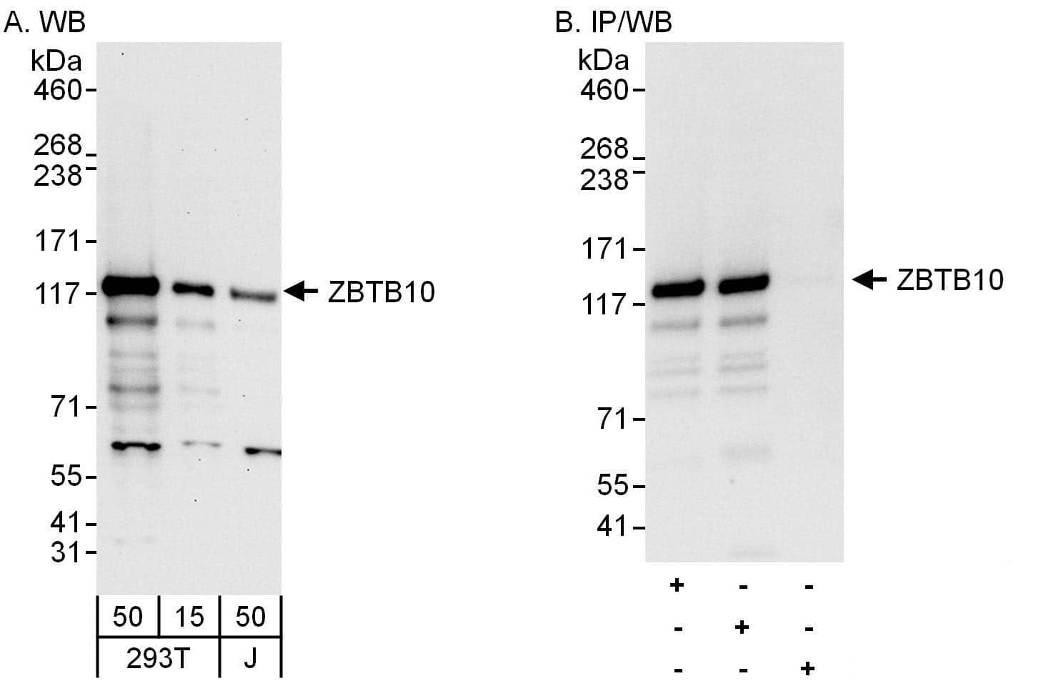 Western Blot:[NBP3-30460]-Detection of human ZBTB10 by western blot and immunoprecipitation. Samples: Whole cell lysate from HEK293T and Jurkat cells. Antibodies: Affinity purified rabbit anti-ZBTB10 antibody used for WB at 0. 1 µg/ml and 1 µg/ml and used for IP at 6 µg/mg lysate. ZBTB10 was also immunoprecipitated by rabbit anti-ZBTB10 antibody , which recognizes an upstream epitope. Detection: Chemiluminescence with exposure times of 30 seconds and 3 seconds.