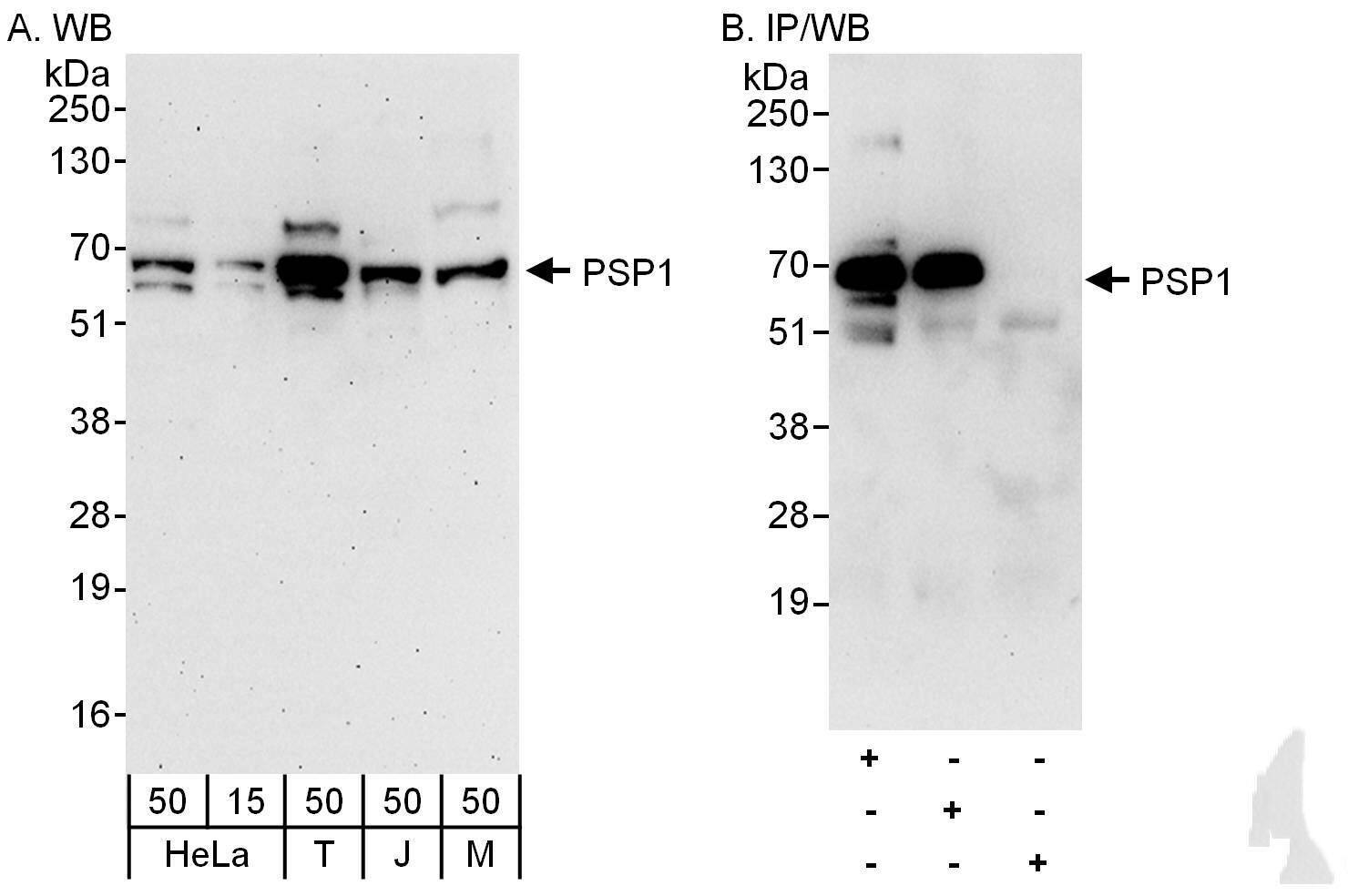 Western Blot:[NBP3-30461]-Detection of human and mouse PSP1 by western blot and immunoprecipitation. Samples: Whole cell lysate from HeLa , HEK293T , Jurkat and mouse NIH 3T3 cells. Antibodies: Affinity purified rabbit anti-PSP1 antibody used for WB at 0. 04 µg/ml and 0. 4 µg/ml and used for IP at 6 µg/mg lysate. PSP1 was also immunoprecipitated by rabbit anti-PSP1 antibody , which recognizes a downstream epitope. Detection: Chemiluminescence with exposure times of 3 minutes and 30 seconds.