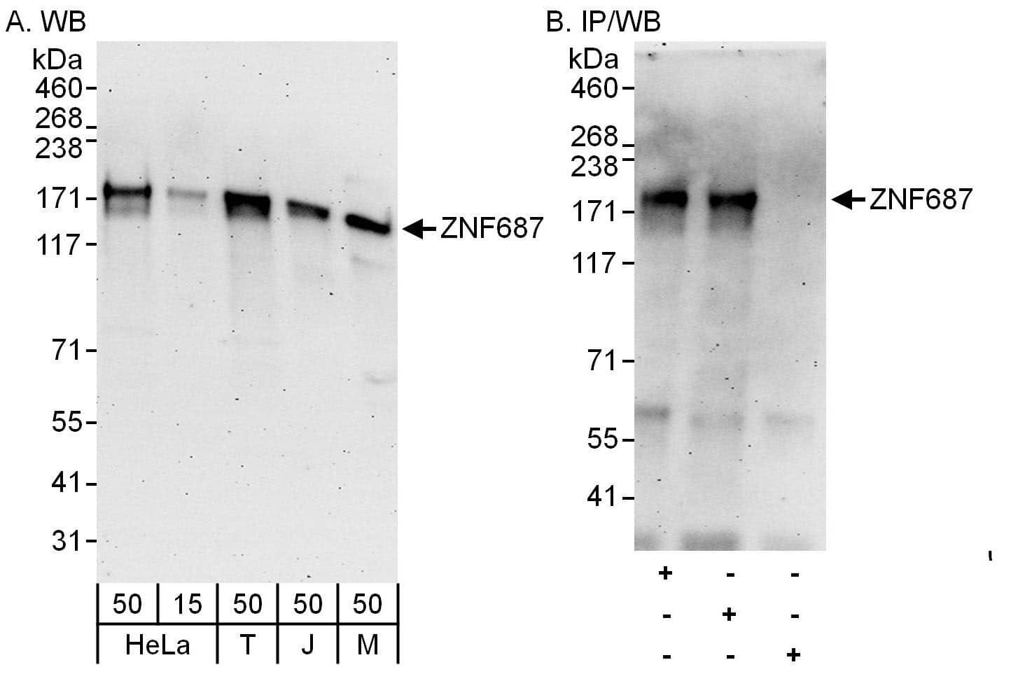 Western Blot ZNF687 Antibody