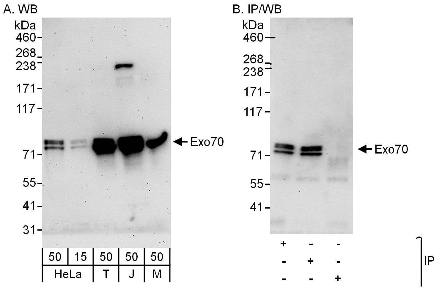 Western Blot:[NBP3-30463]-Detection of human and mouse Exo70 by western blot and immunoprecipitation. Samples: Whole cell lysate from HeLa , HEK293T , Jurkat and mouse NIH 3T3 cells. Antibodies: Affinity purified rabbit anti-Exo70 antibody used for WB at 0. 1 µg/ml and 1 µg/ml and used for IP at 6 µg/mg lysate. Exo70 was also immunoprecipitated by rabbit anti-Exo70 antibody , which recognizes a downstream epitope. Detection: Chemiluminescence with exposure times of 3 minutes and 30 seconds.