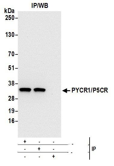 Immunoprecipitation:[NBP3-30464]-Detection of human PYCR1/P5CR by western blot of immunoprecipitates. Samples: Whole cell lysate from 293T cells prepared using NETN lysis buffer. Antibodies: Affinity purified rabbit anti-PYCR1/P5CR antibody used for IP at 6 µg per reaction. PYCR1/P5CR was also immunoprecipitated by rabbit anti-PYCR1/P5CR antibody. For blotting immunoprecipitated PYCR1/P5CR, was used at 1 µg/ml. Detection: Chemiluminescence with an exposure time of 10 seconds.