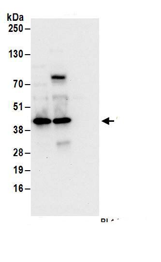 Immunoprecipitation:SEC13 AntibodyNBP3-30465] -Detection of human Sec13 by western blot of immunoprecipitates. Samples: Whole cell lysate (1 mg for IP; 20% of IP loaded) from HEK293T cells. Antibodies: Affinity purified rabbit anti-Sec13 antibody NBP3-30465 (lot NBP3-30465-1) used for IP at 6 µg/mg lysate. Sec13 was also immunoprecipitated by rabbit anti-Sec13 antibody BL14368. For blotting immunoprecipitated Sec13, NBP3-30465 was used at 1 µg/ml. Detection: Chemiluminescence with an exposure time of 10 seconds.