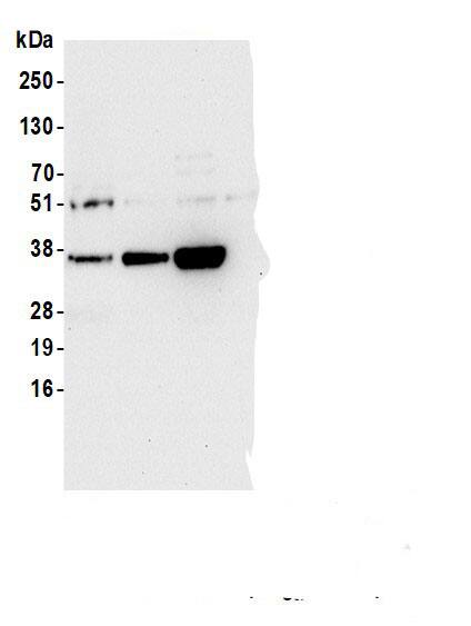 Immunoprecipitation:PGPase AntibodyNBP3-30466] -Detection of human PGP by western blot of immunoprecipitates. Samples: Whole cell lysate (1.0 mg per IP reaction; 20% of IP loaded) from HEK293T cells prepared using NETN lysis buffer. Antibodies: Affinity purified rabbit anti-PGP antibody (NBP3-30466 lot 2) used for IP at 6 µg per reaction. PGP was also immunoprecipitated by a previous lot of this antibody (NBP3-30466 lot 1) and a second.inst a different epitope of PGP . For blotting immunoprecipitated PGP, NBP3-30466 was used at 0.4 mg/ml. Detection: Chemiluminescence with an exposure time of 10 seconds.