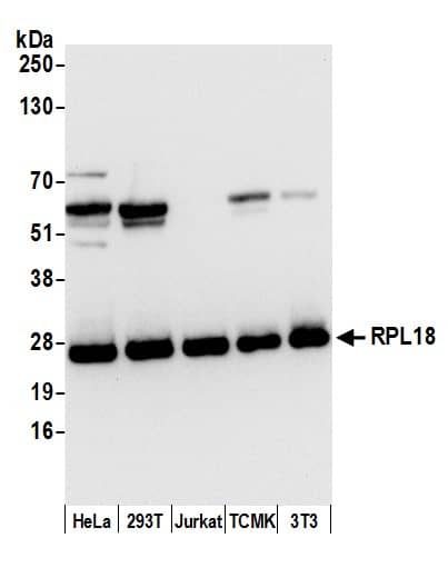 Western Blot:[NBP3-30469]-Detection of human and mouse RPL18 by western blot. Samples: Whole cell lysate from HeLa, HEK293T, Jurkat, mouse TCMK-1, and mouse NIH 3T3 cells prepared using NETN lysis buffer. Antibody: Affinity purified rabbit anti-RPL18 antibody used for WB at 0. 1 µg/ml. Detection: Chemiluminescence with an exposure time of 3 seconds.