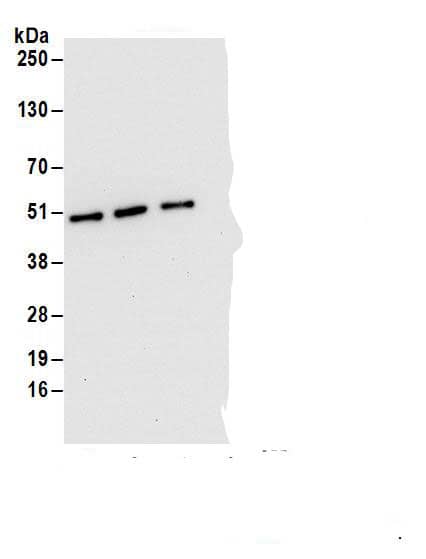 Immunoprecipitation:DAZAP1 AntibodyNBP3-30471] -Detection of human DAZAP1 by western blot of immunoprecipitates. Samples: Whole cell lysate (1 mg for IP; 20% of IP loaded) from HEK293T cells. Antibodies: Affinity purified rabbit anti-DAZAP1 antibody NBP3-30471 (lot NBP3-30471-1) used for IP at 6 µg/mg lysate. DAZAP1 was also immunoprecipitated by rabbit anti-DAZAP1 antibodies . For blotting immunoprecipitated DAZAP1, NBP3-30471 was used at 1 µg/ml. Detection: Chemiluminescence with an exposure time of 30 seconds.