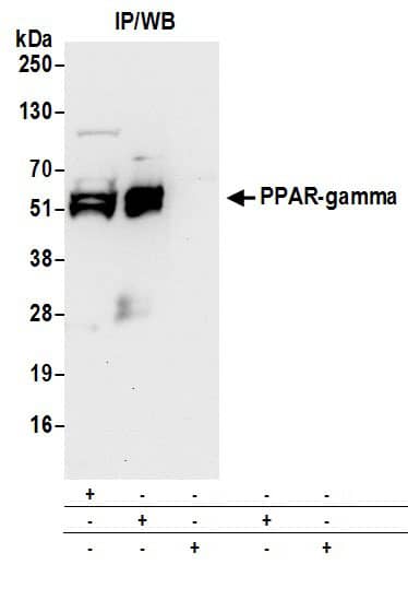 Immunoprecipitation:[NBP3-30473]-Detection of mouse PPAR-gamma by western blot of immunoprecipitates. Samples: Whole cell lysate from differentiated mouse NIH 3T3-L1 cells prepared using NETN lysis buffer. Antibodies: Affinity purified rabbit antibody used for IP at 6 µg per reaction. PPAR-gamma was also immunoprecipitated by rabbit antibody. For blotting immunoprecipitated PPAR-gamma, was used at 0. 1 µg/ml. Detection: Chemiluminescence with an exposure time of 30 seconds.