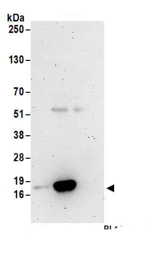 Immunoprecipitation:TCEB2 AntibodyNBP3-30474] -Detection of human TCEB2 by western blot of immunoprecipitates. Samples: Whole cell lysate (1 mg for IP; 20% of IP loaded) from Jurkat cells. Antibodies: Affinity purified rabbit anti-TCEB2 antibody NBP3-30474 (lot NBP3-30474-1) used for IP at 6 µg/mg lysate. TCEB2 was inefficiently immunoprecipitated by rabbit anti-TCEB2 antibody BL14445. For blotting immunoprecipitated TCEB2, NBP3-30474 was used at 1 µg/ml. Detection: Chemiluminescence with an exposure time of 3 minutes.