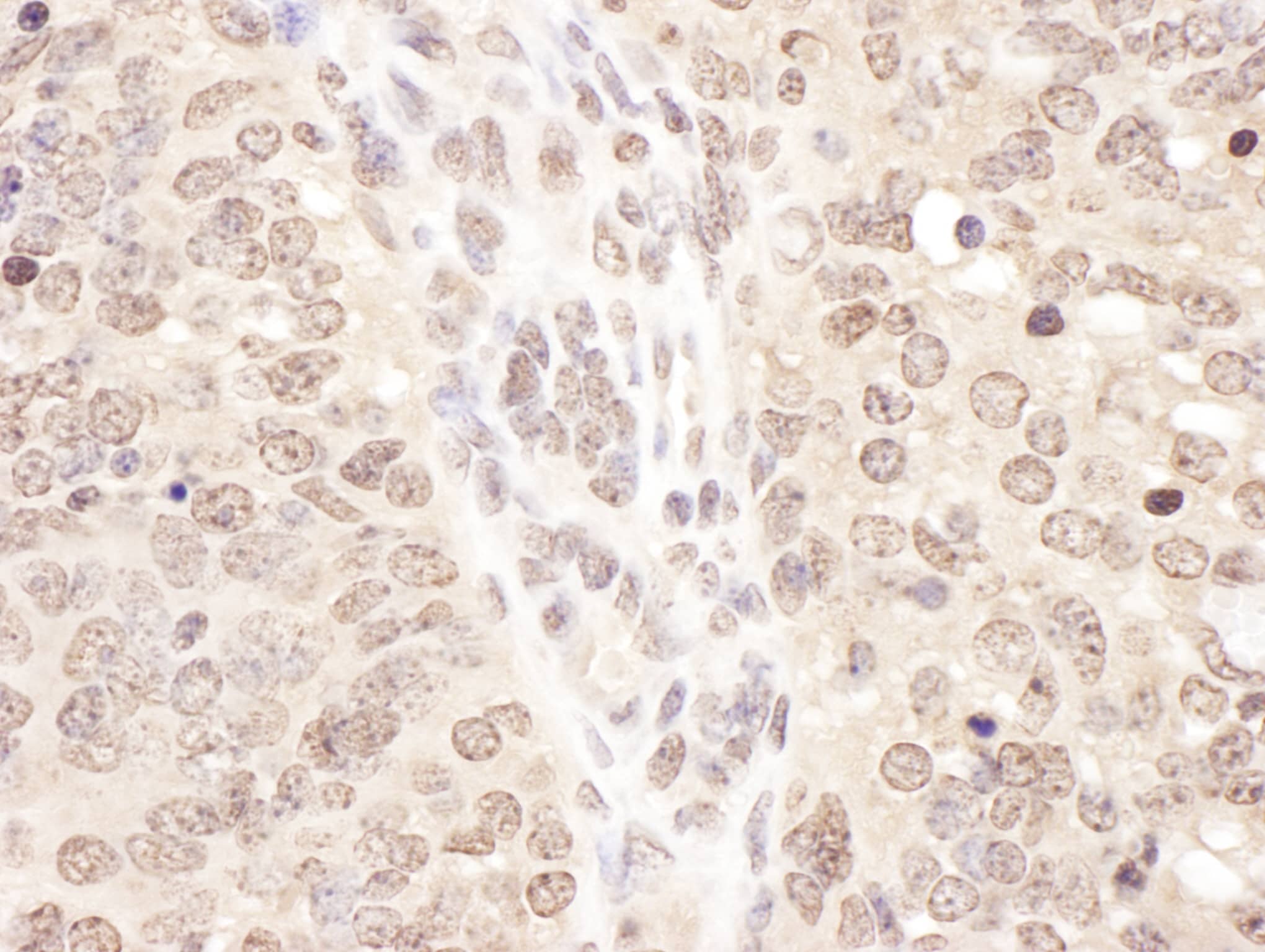 Immunohistochemistry;TCEB2 Antibody[NBP3-30474]Detection of mouse TCEB2 by immunohistochemistry. Sample: FFPE section of mouse teratoma. Antibody: Affinity purified rabbit anti-TCEB2  used at a dilution of 1:1,000 . Detection: DAB