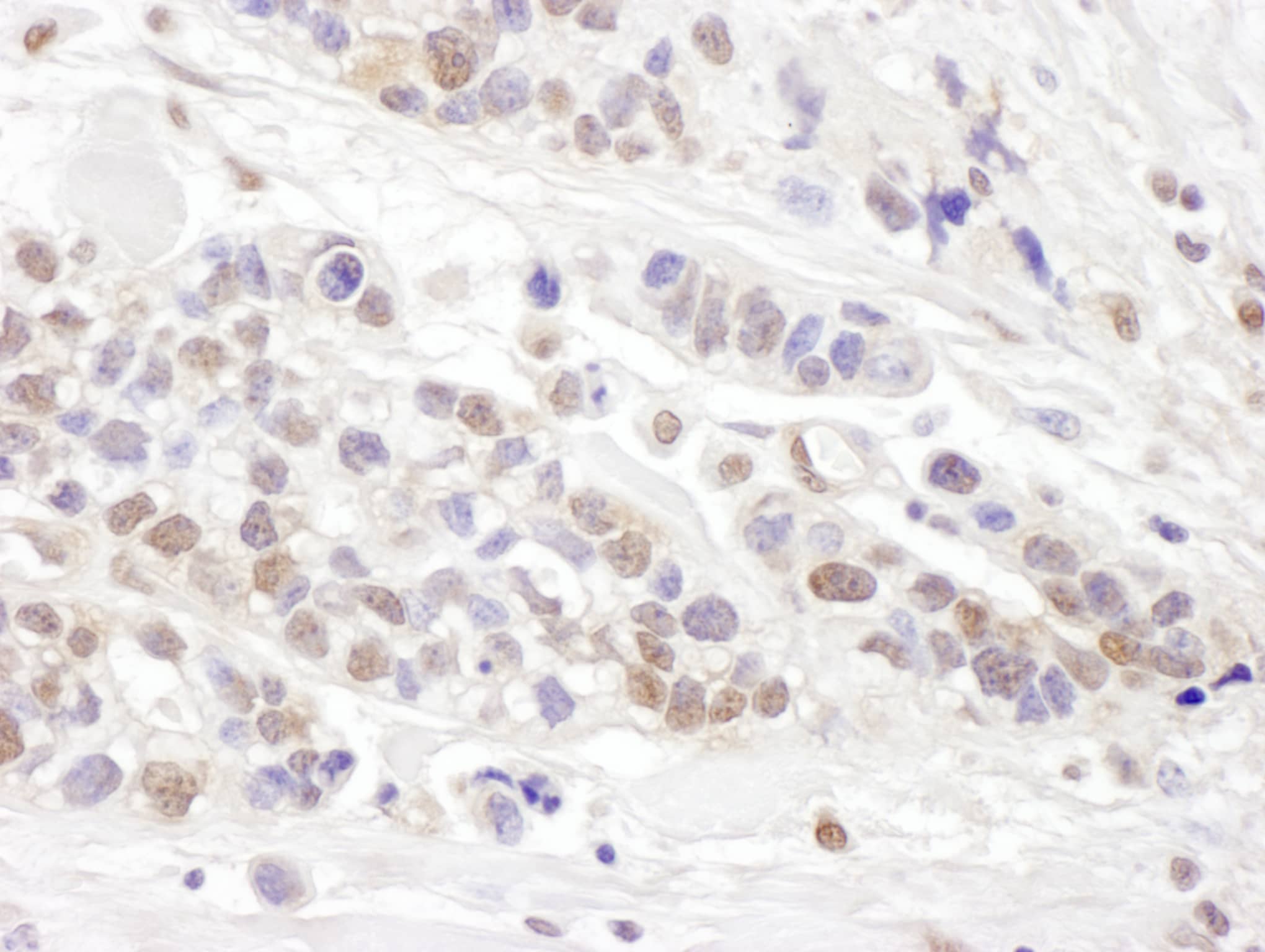 Immunohistochemistry TCEB2 Antibody - BSA Free