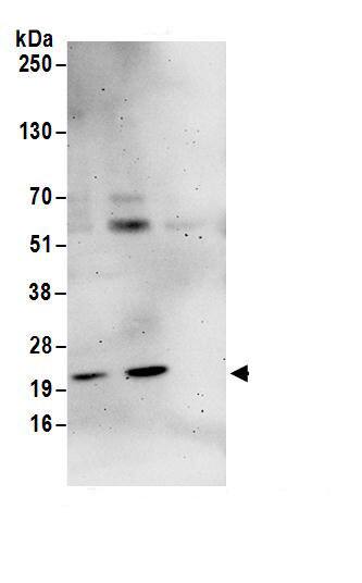 Immunoprecipitation:NIP7 AntibodyNBP3-30477] -Detection of human NIP7 by western blot of immunoprecipitates. Samples: Whole cell lysate (1 mg for IP; 20% of IP loaded) from HeLa cells. Antibodies: Affinity purified rabbit anti-NIP7 antibody NBP3-30477 (lot NBP3-30477-1) used for IP at 6 µg/mg lysate. NIP7 was also immunoprecipitated by rabbit anti-NIP7 antibody BL14344. For blotting immunoprecipitated NIP7, NBP3-30477 was used at 1 µg/ml. Detection: Chemiluminescence with an exposure time of 3 minutes.