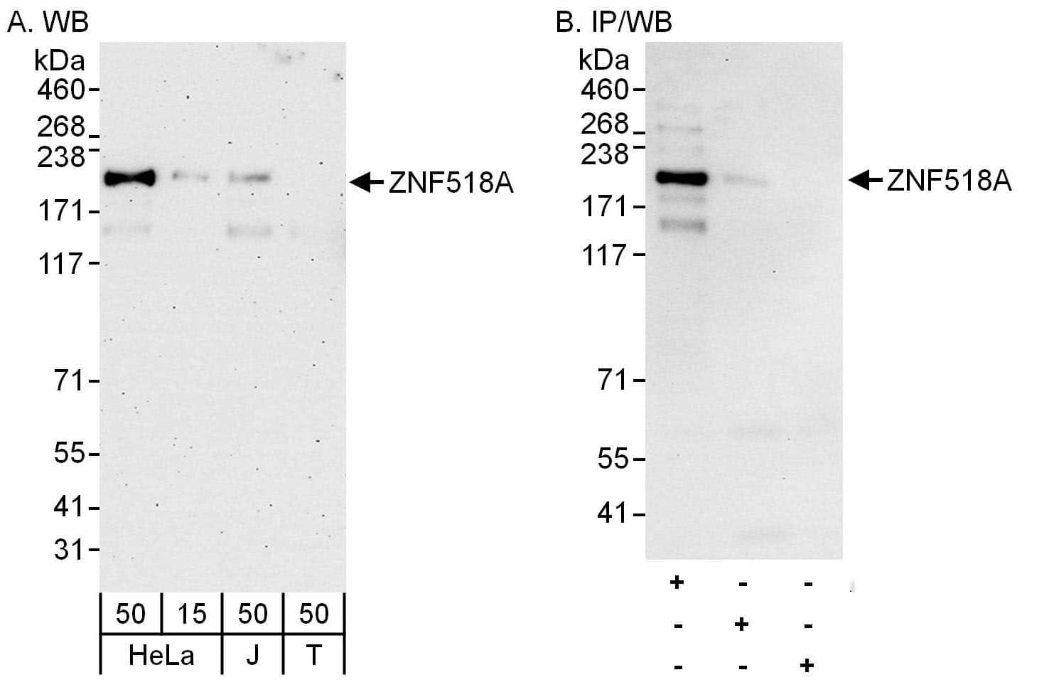 Western Blot:[NBP3-30478]-Detection of human ZNF518A by western blot and immunoprecipitation. Samples: Whole cell lysate from HeLa , Jurkat and HEK293T cells. Antibodies: Affinity purified rabbit antibody used for WB at 0. 1 µg/ml and 1 µg/ml and used for IP at 6 µg/mg lysate. ZNF518A was more efficiently immunoprecipitated by rabbit antibody , which recognizes an upstream epitope. Detection: Chemiluminescence with exposure times of 3 minutes and 10 seconds.