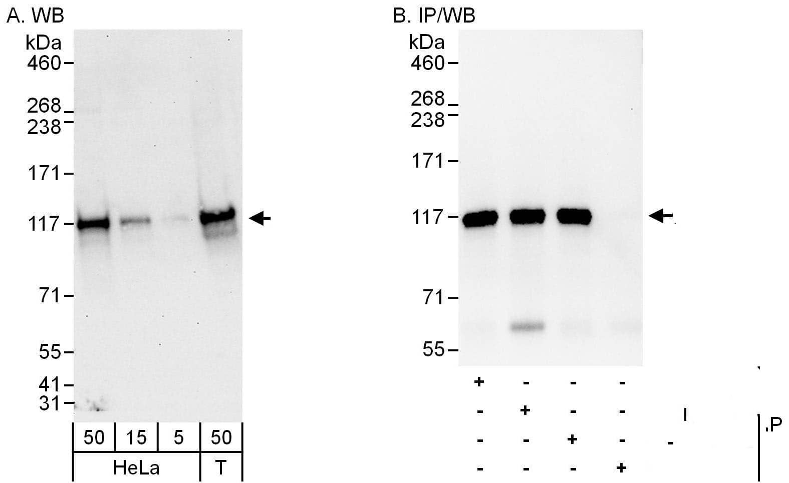Western Blot:[NBP3-30480]-Detection of human ANKLE2 by western blot and immunoprecipitation. Samples: Whole cell lysate from HeLa and HEK293T cells. Antibodies: Affinity purified rabbit anti-ANKLE2 antibody used for WB at 0. 04 µg/ml and 1 µg/ml and used for IP at 3 µg/mg lysate. ANKLE2 was also immunoprecipitated by rabbit anti-ANKLE2 antibodies and , which recognize other epitopes. Detection: Chemiluminescence with exposure times of 30 seconds and 10 seconds.