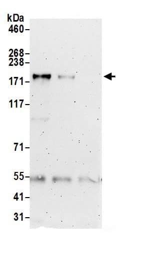 Immunoprecipitation:ZCCHC6 AntibodyNBP3-30482] -Detection of human ZCCHC6 by western blot of immunoprecipitates. Samples: Whole cell lysate (0.5 or 1.0 mg per IP reaction; 20% of IP loaded) from 293T cells. Antibodies: Affinity purified rabbit anti-ZCCHC6 antibody NBP3-30482 (lot NBP3-30482-1) used for IP at 6 µg per reaction. ZCCHC6 was also immunoprecipitated by rabbit anti-ZCCHC6 antibody Brother. For blotting immunoprecipitated ZCCHC6, NBP3-30482 was used at 1 µg/ml. Detection: Chemiluminescence with an exposure time of 3 minutes.