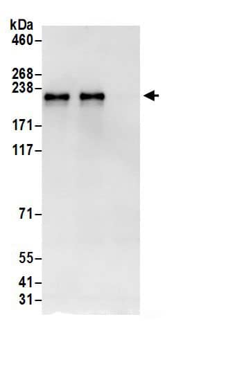 Immunoprecipitation:GOLGA3 AntibodyNBP3-30483] -Detection of human Golgin-160 by western blot of immunoprecipitates. Samples: Whole cell lysate (0.5 or 1.0 mg per IP reaction; 20% of IP loaded) from HeLa cells prepared using NETN lysis buffer. Antibodies: Affinity purified rabbit anti-Golgin-160 antibody NBP3-30483 (lot NBP3-30483-1) used for IP at 6 µg per reaction. Golgin-160 was also immunoprecipitated by rabbit anti-Golgin-160.. For blotting immunoprecipitated Golgin-160, NBP3-30483 was used at 1 µg/ml. Detection: Chemiluminescence with an exposure time of 10 seconds.