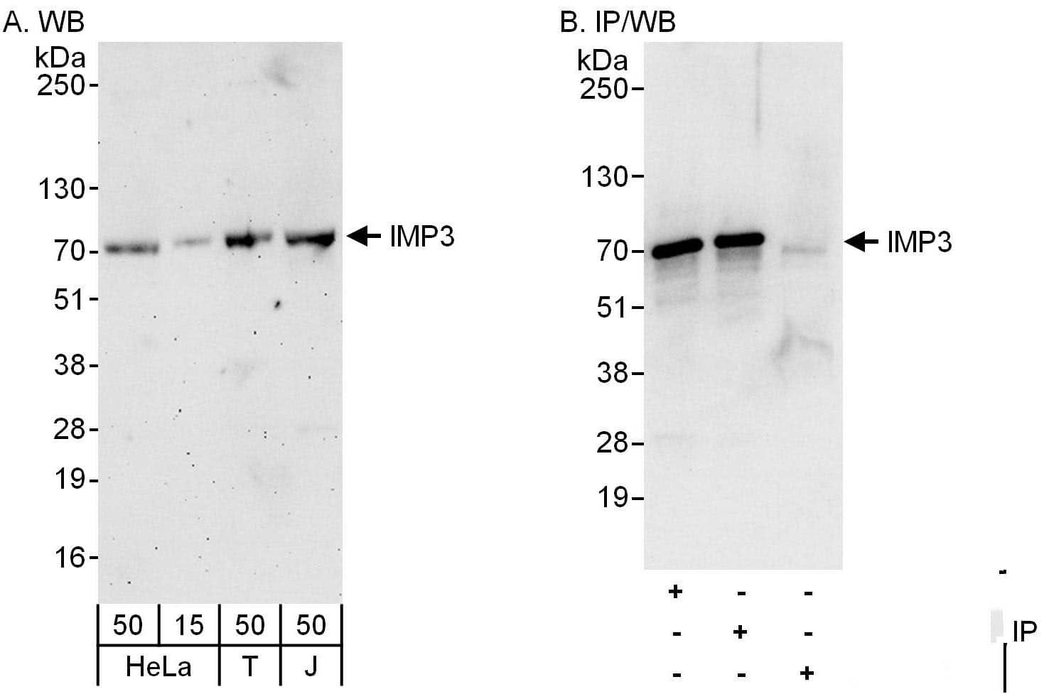 Western Blot:[NBP3-30484]-Detection of human IMP3 by western blot and immunoprecipitation. Samples: Whole cell lysate from HeLa , HEK293T and Jurkat cells. Antibodies: Affinity purified rabbit anti-IMP3 antibody used for WB at 0. 04 µg/ml and 1 µg/ml and used for IP at 6 µg/mg lysate. IMP3 was also immunoprecipitated by rabbit anti-IMP3 antibody , which recognizes a downstream epitope. Detection: Chemiluminescence with exposure times of 3 minutes and 10 seconds.