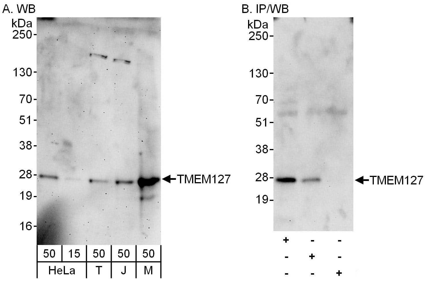 Western Blot TMEM127 Antibody