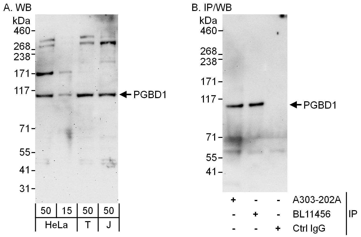 Western Blot:[NBP3-30486]-Detection of human PGBD1 by western blot and immunoprecipitation. Samples: Whole cell lysate from HeLa , HEK293T and Jurkat cells. Antibodies: Affinity purified rabbit anti-PGBD1 antibody used for WB at 0. 4 µg/ml and 1 µg/ml and used for IP at 6 µg/mg lysate. PGBD1 was also immunoprecipitated by rabbit anti-PGBD1 antibody , which recognizes a downstream epitope. Detection: Chemiluminescence with exposure times of 3 minutes and 30 seconds.