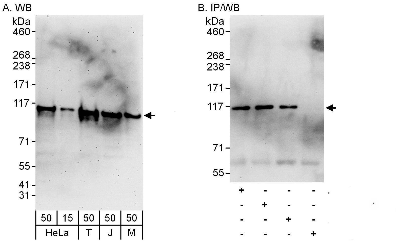 Western Blot:[NBP3-30487]-Detection of human and mouse AARS by western blot and immunoprecipitation. Samples: Whole cell lysate from HeLa , HEK293T , Jurkat and mouse NIH 3T3 cells. Antibodies: Affinity purified rabbit anti-AARS antibody used for WB at 0. 04 µg/ml and 0. 4 µg/ml and used for IP at 6 µg/mg lysate. AARS was also immunoprecipitated by rabbit anti-AARS antibodies and , which recognize downstream epitopes. Detection: Chemiluminescence with exposure times of 3 minutes and 30 seconds.