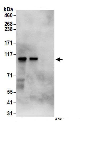 Immunoprecipitation:DAB2 AntibodyNBP3-30488] -Detection of human Dab2 by western blot of immunoprecipitates. Samples: Whole cell lysate (1 mg for IP; 20% of IP loaded) from HeLa cells. Antibodies: Affinity purified rabbit anti-Dab2 antibody NBP3-30488 (lot NBP3-30488-1) used for IP at 6 µg/mg lysate. Dab2 was also immunoprecipitated by rabbit anti-Dab2 antibody for blotting immunoprecipitated Dab2, NBP3-30488 was used at 1 µg/ml. Detection: Chemiluminescence with an exposure time of 10 seconds.