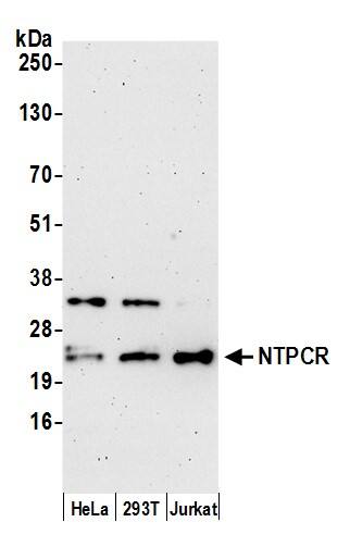 Western Blot:[NBP3-30489]-Detection of human NTPCR by western blot. Samples: Whole cell lysate from HeLa, HEK293T, and Jurkat cells prepared using NETN lysis buffer. Antibody: Affinity purified rabbit anti-NTPCR antibody used for WB at 0. 1 mg/ml. Detection: Chemiluminescence with an exposure time of 3 minutes.