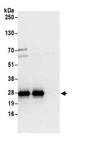 Immunoprecipitation:HN1L AntibodyNBP3-30492] -Detection of human HN1L by western blot of immunoprecipitates. Samples: Whole cell lysate (0.5 or 1.0 mg per IP reaction; 20% of IP loaded) from 293T cells prepared using NETN lysis buffer. Antibodies: Affinity purified rabbit anti-HN1L antibody NBP3-30492 (lot NBP3-30492-1) used for IP at 6 µg per reaction. HN1L was also immunoprecipitated by rabbit anti-HN1L.. For blotting immunoprecipitated HN1L, NBP3-30492 was used at 0.4 µg/ml. Detection: Chemiluminescence with an exposure time of 10 seconds.