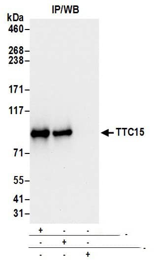 Immunoprecipitation:[NBP3-30493]-Detection of human TTC15 by western blot of immunoprecipitates. Samples: Whole cell lysate from 293T cells prepared using NETN lysis buffer. Antibodies: Affinity purified rabbit anti-TTC15 antibody used for IP at 6 µg per reaction. TTC15 was also immunoprecipitated by rabbit anti-TTC15 antibody. For blotting immunoprecipitated TTC15, was used at 0. 1 µg/ml. Detection: Chemiluminescence with an exposure time of 10 seconds.