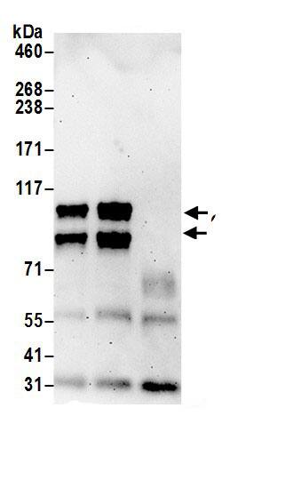 Immunoprecipitation:GRASP1 AntibodyNBP3-30494] -Detection of human GRIPAP1 by western blot of immunoprecipitates. Samples: Whole cell lysate (0.5 or 1.0 mg per IP reaction; 20% of IP loaded) from Jurkat cells prepared using NETN lysis buffer. Antibodies: Affinity purified rabbit anti-GRIPAP1 antibody NBP3-30494 (lot NBP3-30494-1) used for IP at 6 µg per reaction. GRIPAP1 was also immunoprecipitated by rabbit anti-GRIPAP1.. For blotting immunoprecipitated GRIPAP1, NBP3-30494 was used at 0.4 µg/ml. Detection: Chemiluminescence with an exposure time of 3 minutes.