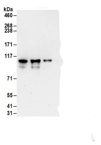 Immunoprecipitation:Exosome component 10 AntibodyNBP3-30497] -Detection of human EXOSC10 by western blot of immunoprecipitates. Samples: Whole cell lysate (1 mg for IP; 20% of IP loaded) from HeLa cells. Antibodies: Affinity purified rabbit anti-EXOSC10 antibody NBP3-30497 (lot NBP3-30497-1) used for IP at 6 µg/mg lysate. EXOSC10 was also immunoprecipitated by rabbit anti-EXOSC10 antibodies for blotting immunoprecipitated EXOSC10, NBP3-30497 was used at 1 µg/ml. Detection: Chemiluminescence with an exposure time of 30 seconds.