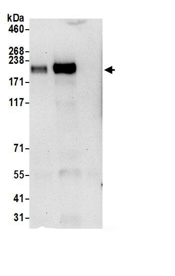 Immunoprecipitation:CPD AntibodyNBP3-30498] -Detection of human CPD by western blot of immunoprecipitates. Samples: Whole cell lysate (0.5 or 1.0 mg per IP reaction; 20% of IP loaded) from 293T cells prepared using NETN lysis buffer. Antibodies: Affinity purified rabbit anti-CPD antibody NBP3-30498 (lot NBP3-30498-1) used for IP at 6 µg per reaction. CPD was also immunoprecipitated by rabbit anti-CPD antibody BL21726. For blotting immunoprecipitated CPD, NBP3-30498 was used at 1 µg/ml. Detection: Chemiluminescence with an exposure time of 30 seconds.