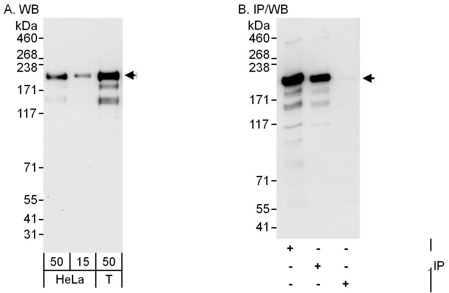 Western Blot:[NBP3-30499]-Detection of human CLIP170 by western blot and immunoprecipitation. Samples: Whole cell lysate from HeLa and HEK293T cells. Antibodies: Affinity purified rabbit anti-CLIP170 antibody used for WB at 0. 1 µg/ml and 1 µg/ml and used for IP at 6 µg/mg lysate. CLIP170 was also immunoprecipitated by rabbit anti-CLIP170 antibody , which recognizes a downstream epitope. Detection: Chemiluminescence with exposure times of 30 seconds and 10 seconds.