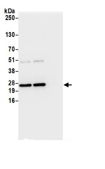 Immunoprecipitation:Glyoxalase I AntibodyNBP3-30500] -Detection of human GLO1/Glyoxalase I by western blot of immunoprecipitates. Samples: Whole cell lysate (0.5 or 1.0 mg per IP reaction; 20% of IP loaded) from 293T cells prepared using NETN lysis buffer. Antibodies: Affinity purified rabbit anti-GLO1/Glyoxalase I antibody NBP3-30500 (lot NBP3-30500-1) used for IP at 6 µg per reaction. GLO1/Glyoxalase I was also immunoprecipitated by rabbit anti-GLO1/Glyoxalase I.. For blotting immunoprecipitated GLO1/Glyoxalase I, NBP3-30500 was used at 0.4 µg/ml. Detection: Chemiluminescence with an exposure time of 1 second.