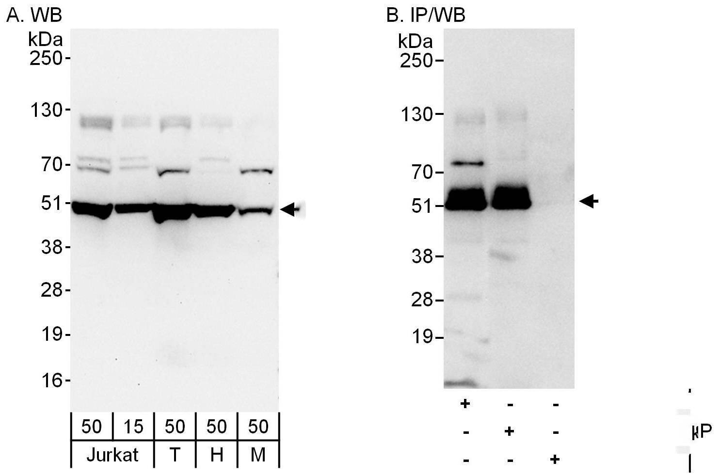 Western Blot:[NBP3-30501]-Detection of human and mouse DCTN2 by western blot and immunoprecipitation. Samples: Whole cell lysate from Jurkat , HEK293T , HeLa and mouse NIH 3T3 cells. Antibodies: Affinity purified rabbit anti-DCTN2 antibody used for WB at 0. 1 µg/ml and 1 µg/ml and used for IP at 6 µg/mg lysate. DCTN2 was also immunoprecipitated by rabbit anti-DCTN2 antibody , which recognizes a downstream epitope. Detection: Chemiluminescence with exposure times of 30 seconds and 3 seconds.