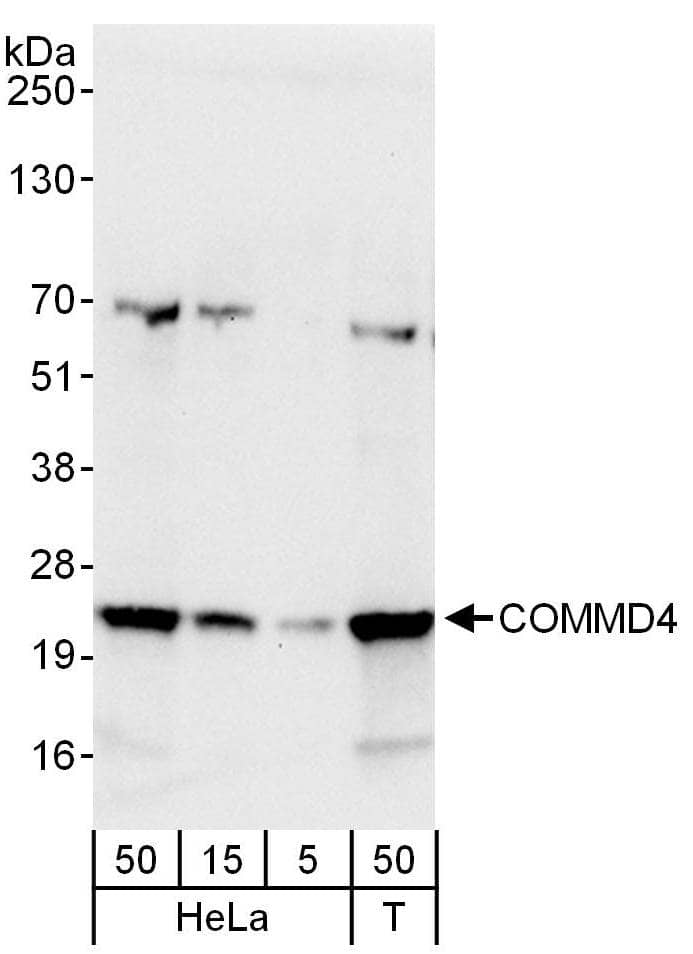 Western Blot:[NBP3-30505]-Detection of human COMMD4 by western blot. Samples: Whole cell lysate from HeLa and HEK293T cells. Antibodies: Affinity purified rabbit anti-COMMD4 antibody used for WB at 0. 4 µg/ml. Detection: Chemiluminescence with an exposure time of 10 seconds.