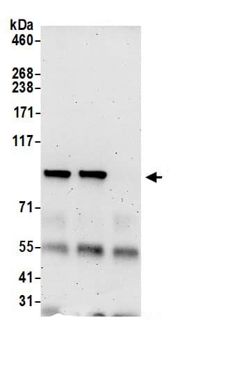Immunoprecipitation:HECTD3 AntibodyNBP3-30510] -Detection of human HECTD3 by western blot of immunoprecipitates. Samples: Whole cell lysate (0.5 or 1.0 mg per IP reaction; 20% of IP loaded) from 293T cells prepared using NETN lysis buffer. Antibodies: Affinity purified rabbit anti-HECTD3 antibody NBP3-30510 (lot NBP3-30510-1) used for IP at 6 µg per reaction. HECTD3 was also immunoprecipitated by rabbit anti-HECTD3 antibody. For blotting immunoprecipitated HECTD3, NBP3-30510 was used at 1 µg/ml. Detection: Chemiluminescence with an exposure time of 3 minutes.