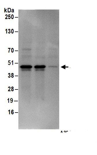 Immunoprecipitation:Septin-2 AntibodyNBP3-30511] -Detection of human Septin 2 by western blot of immunoprecipitates. Samples: Whole cell lysate (1 mg for IP; 20% of IP loaded) from 293T cells. Antibodies: Affinity purified rabbit anti-Septin 2 antibody NBP3-30511 (lot NBP3-30511-1) used for IP at 6 µg/mg lysate. Septin 2 was also immunoprecipitated by rabbit anti-Septin 2.. For blotting immunoprecipitated Septin 2, NBP3-30511 was used at 1 µg/ml. Detection: Chemiluminescence with an exposure time of 3 seconds.