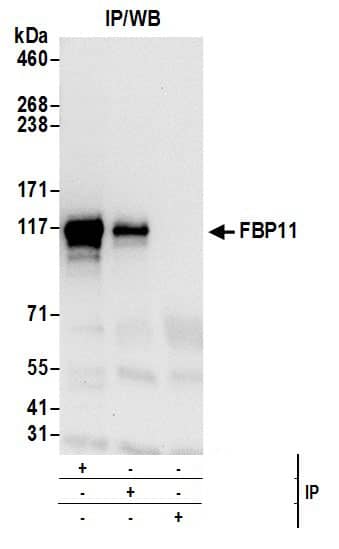 Immunoprecipitation:[NBP3-30512]-Detection of human FBP11 by western blot of immunoprecipitates. Samples: Whole cell lysate from 293T cells prepared using NETN lysis buffer. Antibodies: Affinity purified rabbit anti-FBP11 antibody used for IP at 6 µg per reaction. FBP11 was also immunoprecipitated by rabbit anti-FBP11 antibody. For blotting immunoprecipitated FBP11, was used at 0. 4 µg/ml. Detection: Chemiluminescence with an exposure time of 10 seconds.