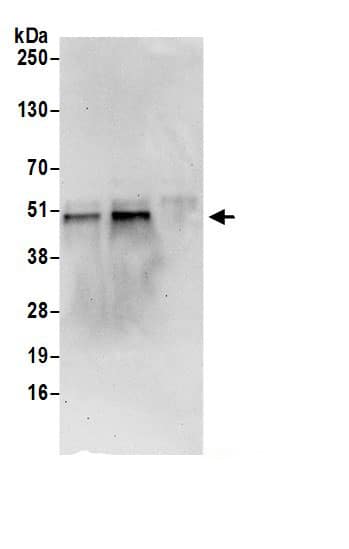 Immunoprecipitation:CDC123 AntibodyNBP3-30513] -Detection of human CDC123 by western blot of immunoprecipitates. Samples: Whole cell lysate (0.5 or 1.0 mg per IP reaction; 20% of IP loaded) from 293T cells prepared using NETN lysis buffer. Antibodies: Affinity purified rabbit anti-CDC123 antibody NBP3-30513 (lot NBP3-30513-1) used for IP at 6 µg per reaction. CDC123 was also immunoprecipitated by rabbit anti-CDC123 antibody BL19660. For blotting immunoprecipitated CDC123, NBP3-30513 was used at 1 µg/ml. Detection: Chemiluminescence with an exposure time of 30 seconds.