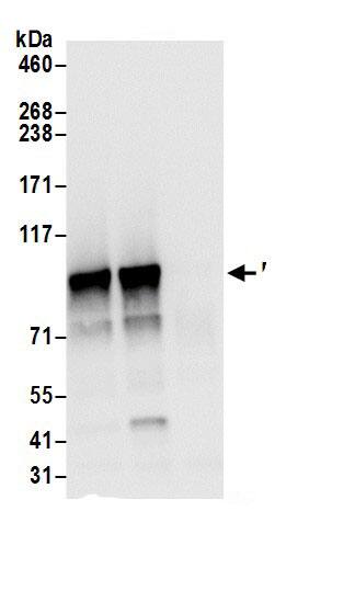 Immunoprecipitation:ELAC2 AntibodyNBP3-30514] -Detection of human ELAC2 by western blot of immunoprecipitates. Samples: Whole cell lysate (0.5 or 1.0 mg per IP reaction; 20% of IP loaded) from 293T cells prepared using NETN lysis buffer. Antibody: Affinity purified rabbit anti-ELAC2 antibody NBP3-30514 (lot NBP3-30514-1) used for IP at 6 µg per reaction. ELAC2 was also immunoprecipitated by rabbit anti-ELAC2.. For blotting immunoprecipitated ELAC2, NBP3-30514 was used at 0.4 µg/ml. Detection: Chemiluminescence with an exposure time of 3 seconds.