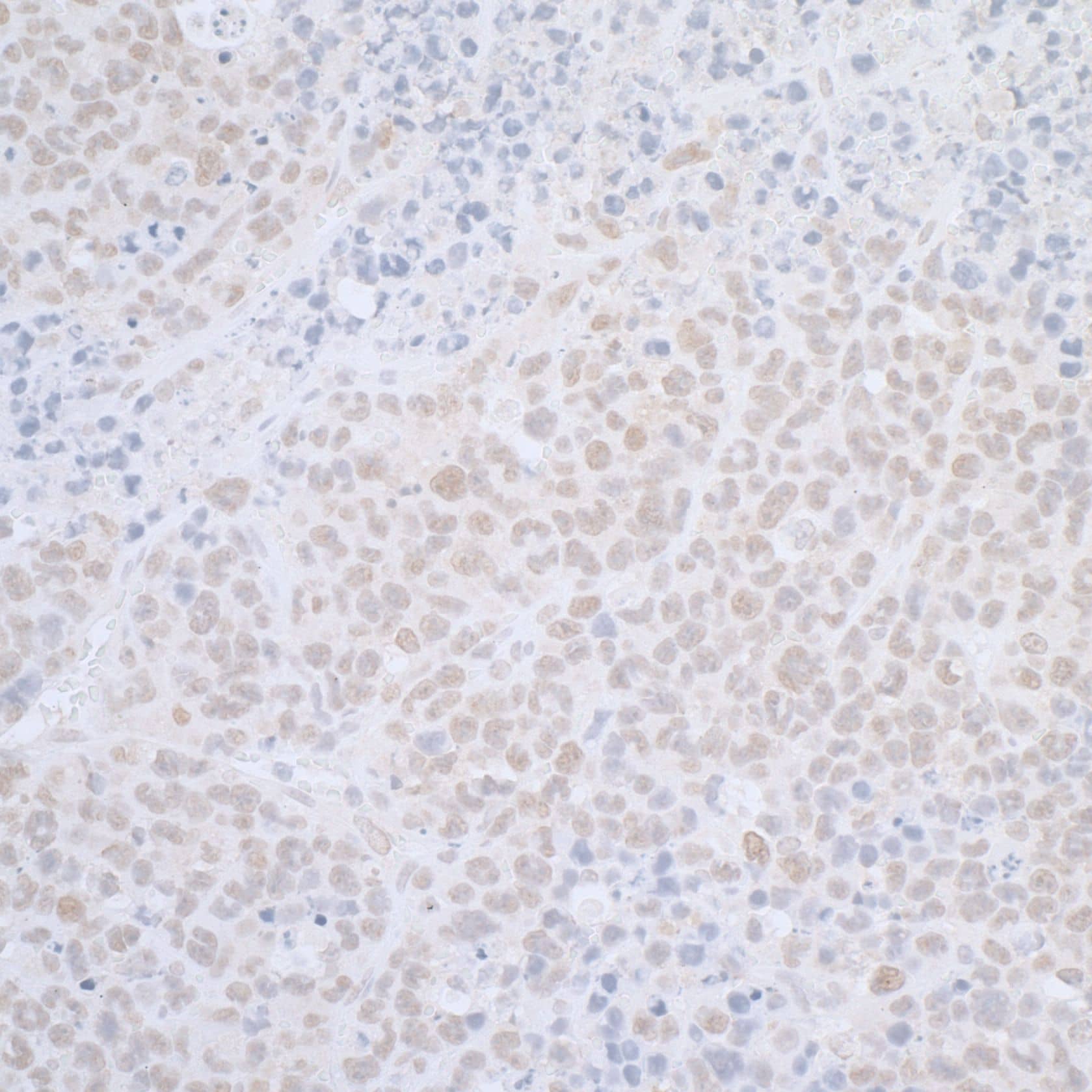 Immunohistochemistry;ELAC2 Antibody[NBP3-30514]Detection of mouse ELAC2 by immunohistochemistry. Sample: FFPE section of mouse plasmacytoma. Antibody: Affinity purified rabbit anti-ELAC2  used at a dilution of 1:1,000 . Detection: DAB