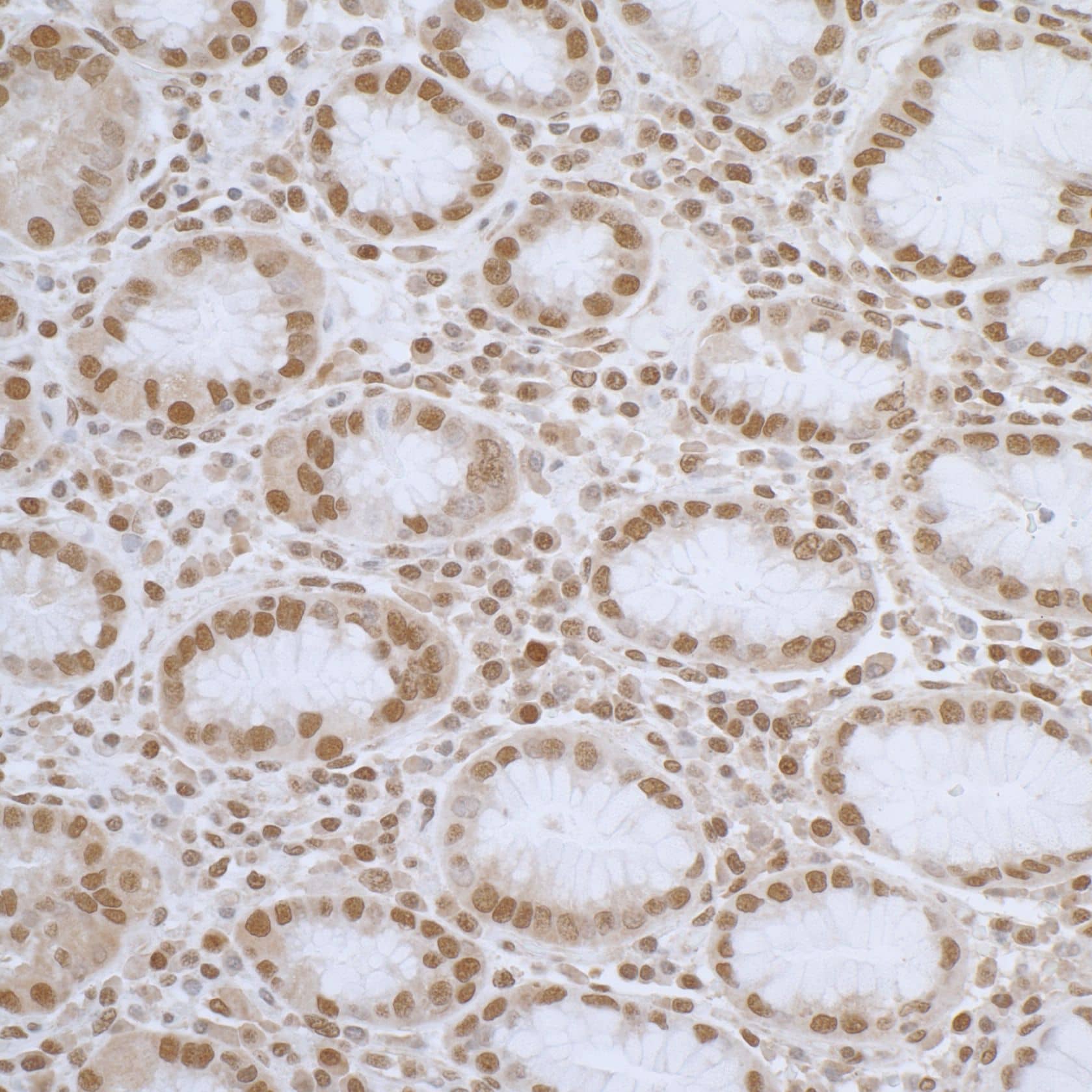 Immunohistochemistry;ELAC2 Antibody[NBP3-30497]Detection of human ELAC2 by immunohistochemistry. Sample: FFPE section of human stomach. Antibody: Affinity purified rabbit anti-ELAC2  used at a dilution of 1:1,000 . Detection: DAB