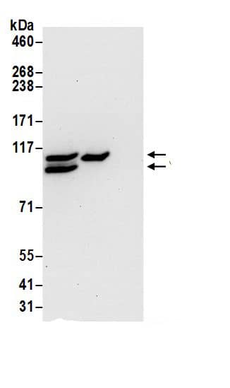 Immunoprecipitation:COPB2 AntibodyNBP3-30515] -Detection of human COPB2 by western blot of immunoprecipitates. Samples: Whole cell lysate (0.5 or 1.0 mg per IP reaction; 20% of IP loaded) from 293T cells prepared using NETN lysis buffer. Antibodies: Affinity purified rabbit anti-COPB2 antibody NBP3-30515 (lot NBP3-30515-1) used for IP at 6 µg per reaction. COPB2 was also immunoprecipitated by rabbit anti-COPB2.. For blotting immunoprecipitated COPB2, NBP3-30515 was used at 0.1 µg/ml. Detection: Chemiluminescence with an exposure time of 30 seconds.