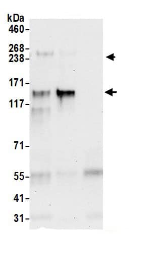 Immunoprecipitation:RBBP6 AntibodyNBP3-30517] -Detection of human RBBP6 by western blot of immunoprecipitates. Samples: Whole cell lysate (0.5 or 1.0 mg per IP reaction; 20% of IP loaded) from 293T cells prepared using NETN lysis buffer. Antibodies: Affinity purified rabbit anti-RBBP6 antibody NBP3-30517 (lot NBP3-30517-1) used for IP at 6 µg per reaction. RBBP6 was also immunoprecipitated by rabbit anti-RBBP6.. For blotting immunoprecipitated RBBP6, NBP3-30517 was used at 0.4 µg/ml. Detection: Chemiluminescence with an exposure time of 30 seconds.