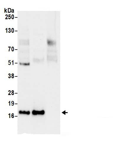 Immunoprecipitation:60S ribosomal protein L23 AntibodyNBP3-30518] -Detection of human Ribosomal Protein L23 by western blot of immunoprecipitates. Samples: Whole cell lysate (0.5 or 1.0 mg per IP reaction; 20% of IP loaded) from 293T cells prepared using NETN lysis buffer. Antibodies: Affinity purified rabbit anti-Ribosomal Protein L23 antibody NBP3-30518 (lot NBP3-30518-1) used for IP at 6 µg per reaction. Ribosomal Protein L23 was also immunoprecipitated by rabbit anti-Ribosomal Protein L23.. For blotting immunoprecipitated Ribosomal Protein L23, NBP3-30518 was used at 1 µg/ml. Detection: Chemiluminescence with an exposure time of 10 seconds.