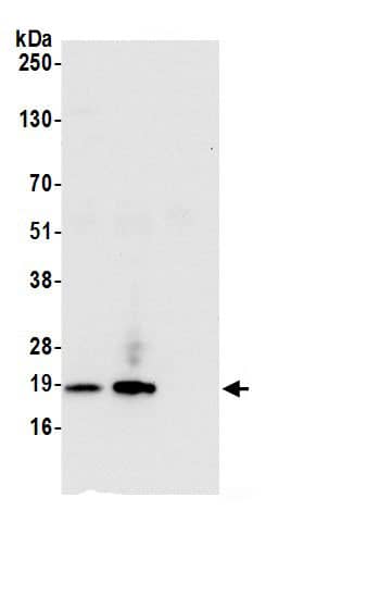 Immunoprecipitation:RPS15 AntibodyNBP3-30519] -Detection of human RPS15 by western blot of immunoprecipitates. Samples: Whole cell lysate (0.5 or 1.0 mg per IP reaction; 20% of IP loaded) from 293T cells prepared using NETN lysis buffer. Antibodies: Affinity purified rabbit anti-RPS15 antibody NBP3-30519 (lot NBP3-30519-1) used for IP at 6 µg per reaction. RPS15 was also immunoprecipitated by rabbit anti-RPS15.. For blotting immunoprecipitated RPS15, NBP3-30519 was used at 0.4 µg/ml. Detection: Chemiluminescence with an exposure time of 10 seconds.