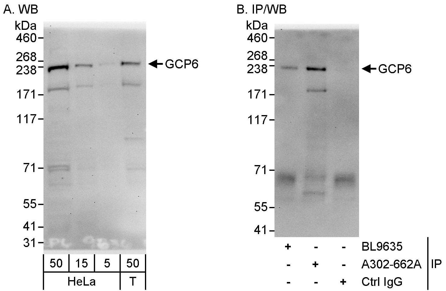 Western Blot:[NBP3-30520]-Detection of human GCP6 by western blot and immunoprecipitation. Samples: Whole cell lysate from HeLa and HEK293T cells. Antibodies: Affinity purified rabbit anti-GCP6 antibody used for WB at 0. 1 µg/ml and 1 µg/ml and used for IP at 3 µg/mg lysate. GCP6 was also immunoprecipitated by rabbit anti-GCP6 antibody BL9635, which recognizes an upstream epitope. Detection: Chemiluminescence with exposure times of 30 seconds.