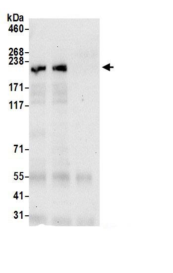 Immunoprecipitation:alpha Desmuslin AntibodyNBP3-30521] -Detection of human SYNM by western blot of immunoprecipitates. Samples: Whole cell lysate (0.5 or 1.0 mg per IP reaction; 20% of IP loaded) from HeLa cells prepared using NETN lysis buffer. Antibodies: Affinity purified rabbit anti-SYNM antibody NBP3-30521 (lot NBP3-30521-1) used for IP at 6 µg per reaction. SYNM was also immunoprecipitated by rabbit anti-SYNM.. For blotting immunoprecipitated SYNM, NBP3-30521 was used at 1 µg/ml. Detection: Chemiluminescence with an exposure time of 30 seconds.