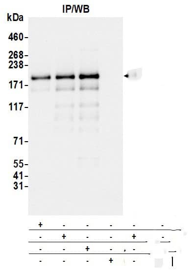 Immunoprecipitation:[NBP3-30522]-Detection of human BLM by western blot of immunoprecipitates. Samples: Whole cell lysate from HEK293T cells prepared using NETN lysis buffer. Antibodies: Affinity purified rabbit anti-BLM antibody used for IP at 6 µg per reaction. BLM was also immunoprecipitated by a previous lot of this antibody and a second antibody against a different epitope of BLM. For blotting immunoprecipitated BLM, was used at 0. 04 µg/ml. Detection: Chemiluminescence with an exposure time of 3 seconds.