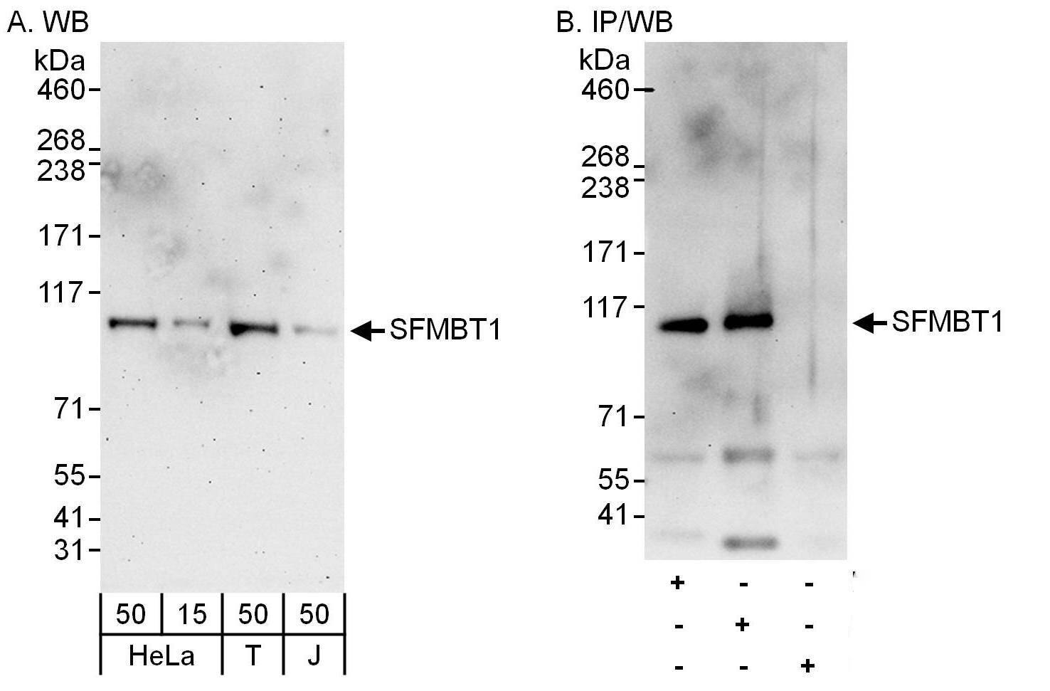Western Blot:[NBP3-30523]-Detection of human SFMBT1 by western blot and immunoprecipitation. Samples: Whole cell lysate from HeLa , HEK293T and Jurkat cells. Antibodies: Affinity purified rabbit anti-SFMBT1 antibody used for WB at 0. 1 µg/ml and 1 µg/ml and used for IP at 6 µg/mg lysate. SFMBT1 was also immunoprecipitated by rabbit anti-SFMBT1 antibody , which recognizes an upstream epitope. Detection: Chemiluminescence with exposure times of 3 minutes and 30 seconds.