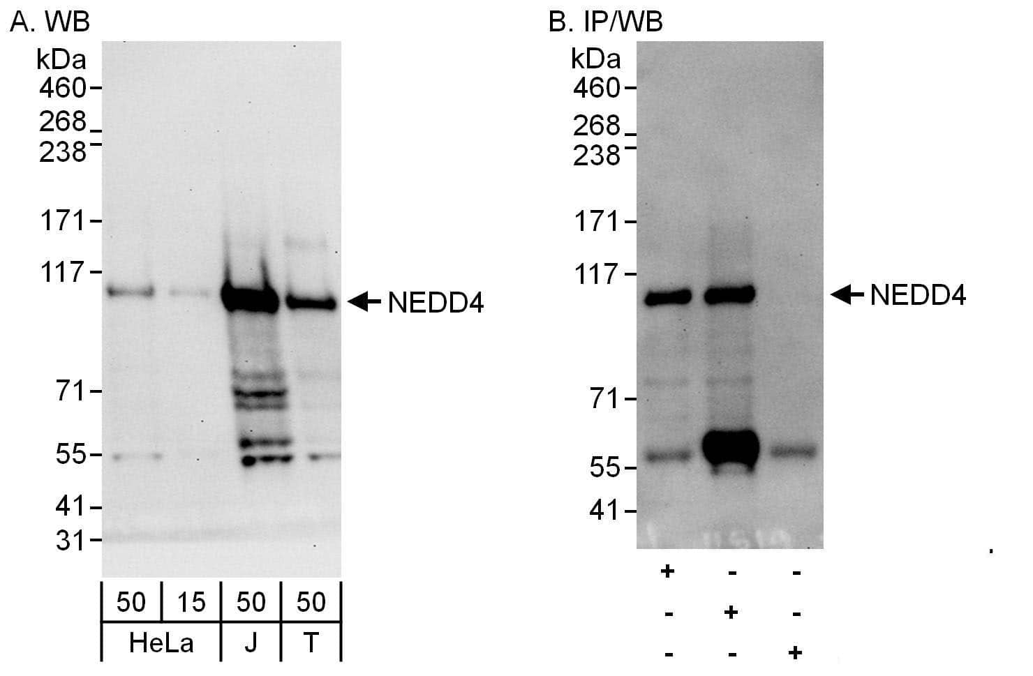 Western Blot:[NBP3-30524]-Detection of human NEDD4 by western blot and immunoprecipitation. Samples: Whole cell lysate from HeLa , Jurkat and HEK293T cells. Antibodies: Affinity purified rabbit anti-NEDD4 antibody used for WB at 0. 1 µg/ml and 1 µg/ml and used for IP at 6 µg/mg lysate. NEDD4 was also immunoprecipitated by rabbit anti-NEDD4 antibody , which recognizes an upstream epitope. Detection: Chemiluminescence with exposure times of 30 seconds.